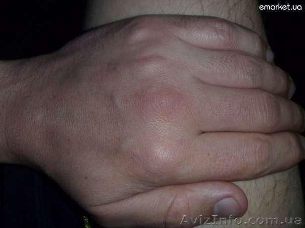 МАССАЖ, общий, антицелюлитный, лечебный - <ro>Изображение</ro><ru>Изображение</ru> #1, <ru>Объявление</ru> #441528