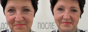 Услуги врача-косметолога в Николаеве - клиника Златадерма - <ro>Изображение</ro><ru>Изображение</ru> #5, <ru>Объявление</ru> #932085
