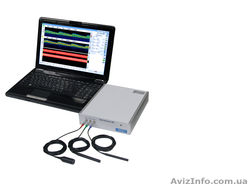Кардиограф, допплер, энцефалограф, миограф, реограф Николаев - <ro>Изображение</ro><ru>Изображение</ru> #8, <ru>Объявление</ru> #1048456